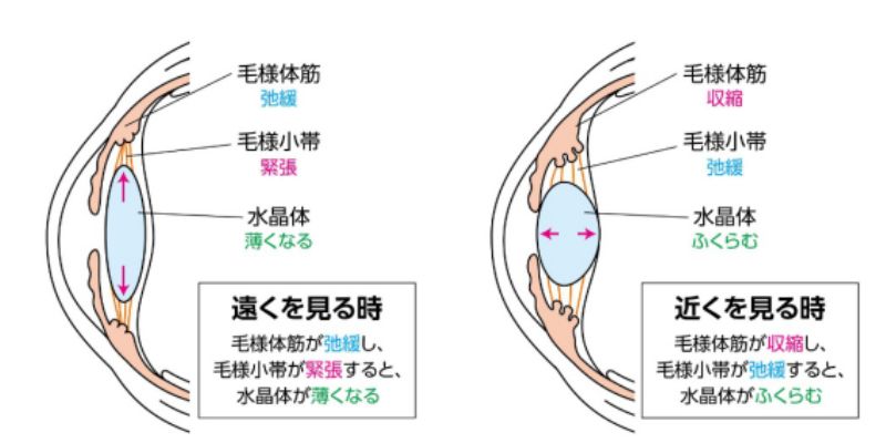 毛様体筋についての断面イラスト