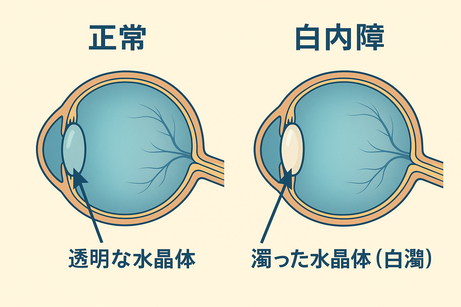 視力検査 ぼやけて見えていても答えていいのかについての画像