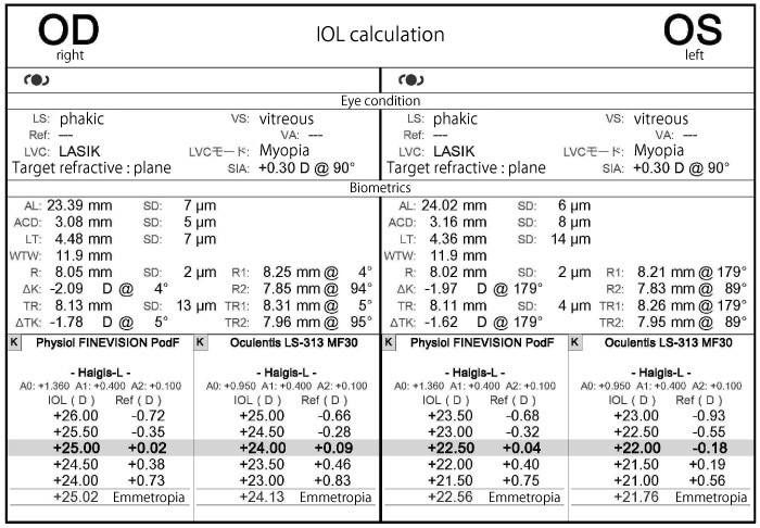 IOL calculation graph