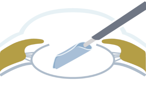 Laser cataract surgery process STEP6 Insert intraocular lens