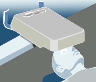 Corneal cross-linking surgery flow：STEP2 image