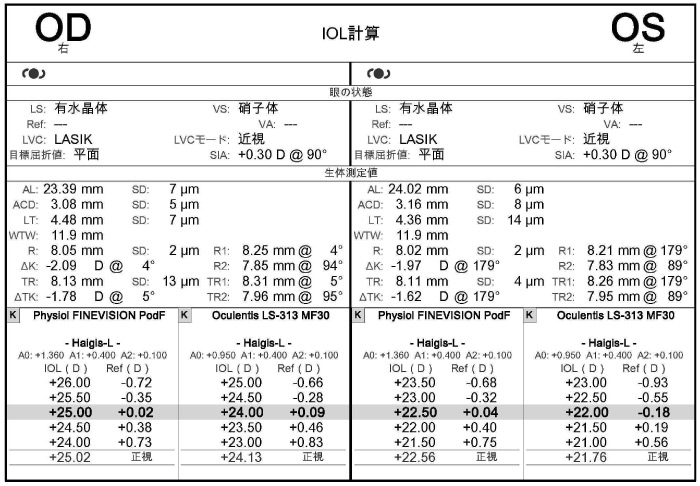 IOL計算のグラフ