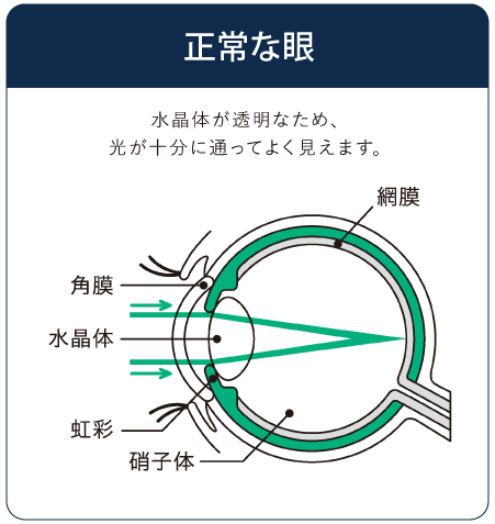 正常な眼のイラスト