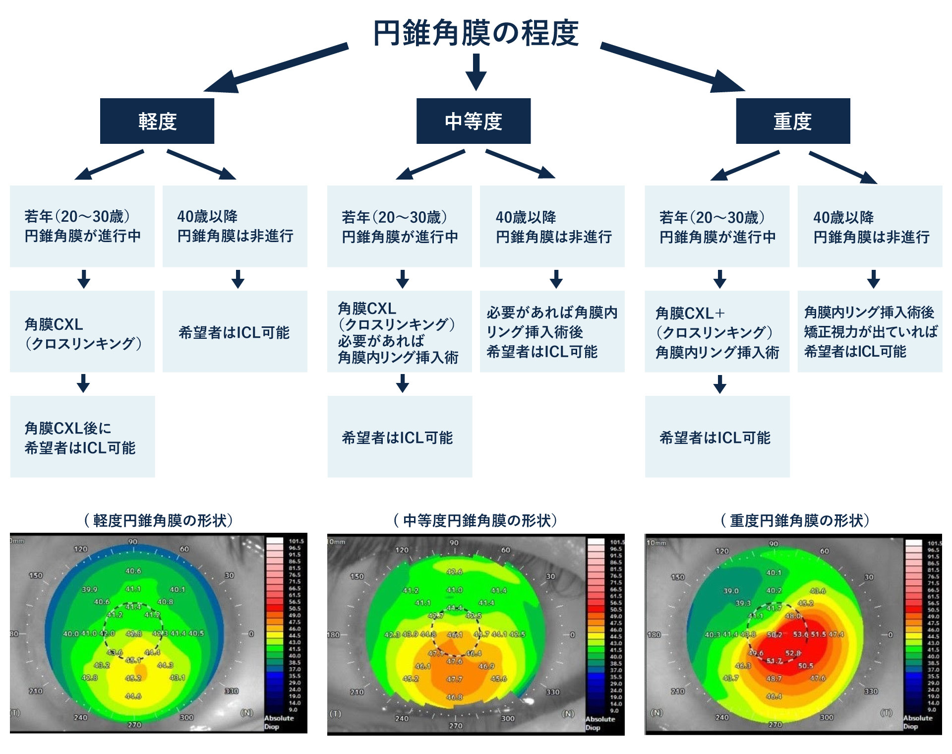 円錐角膜の治療とICLフローチャート