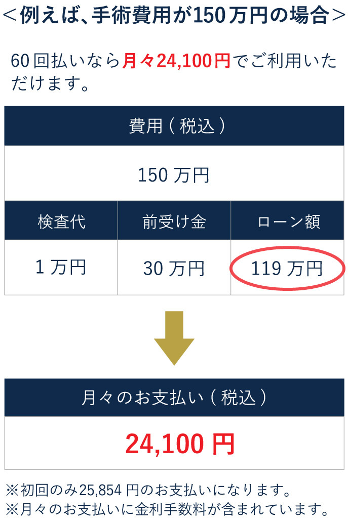 レーザー白内障手術（150万円の場合）の分割価格表