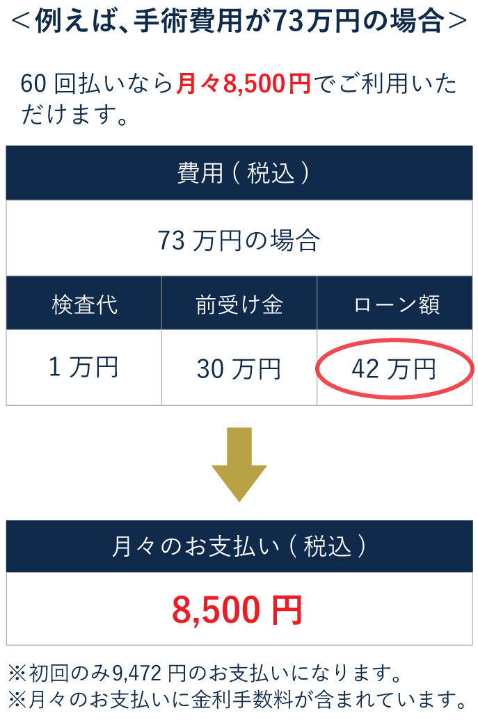 ICL手術73万円の場合の60回払いの分割価格表