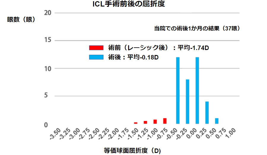 ICL手術前後の屈折度