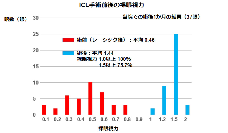 ICL手術前後の裸眼視力