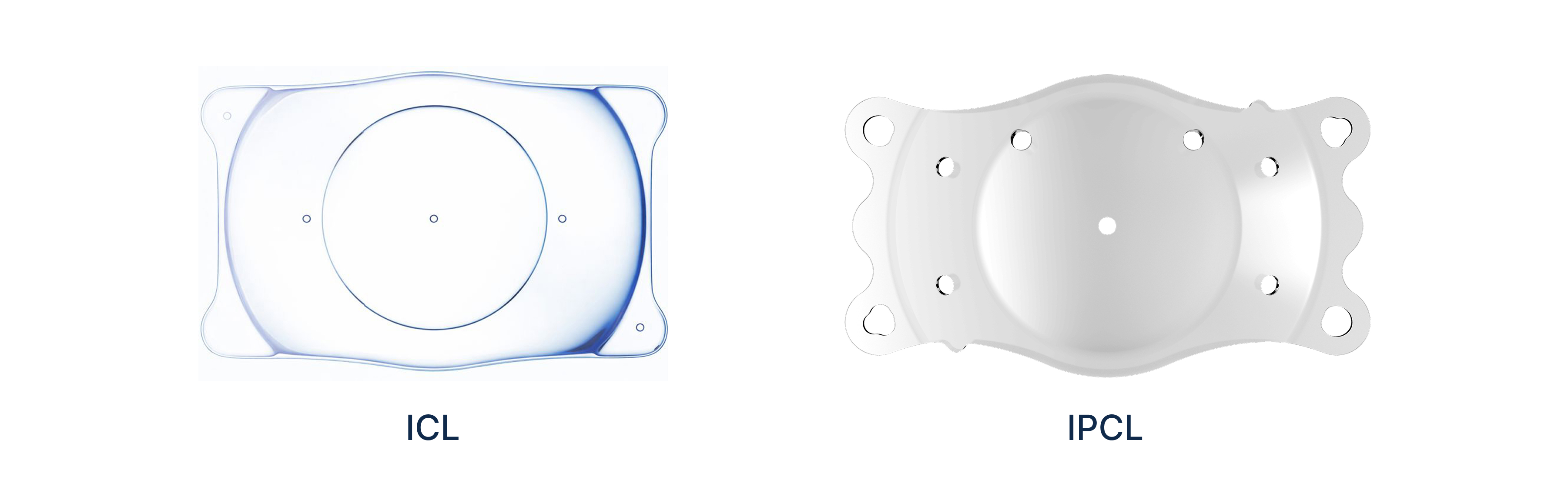 乱視付きICL手術前後の乱視度数